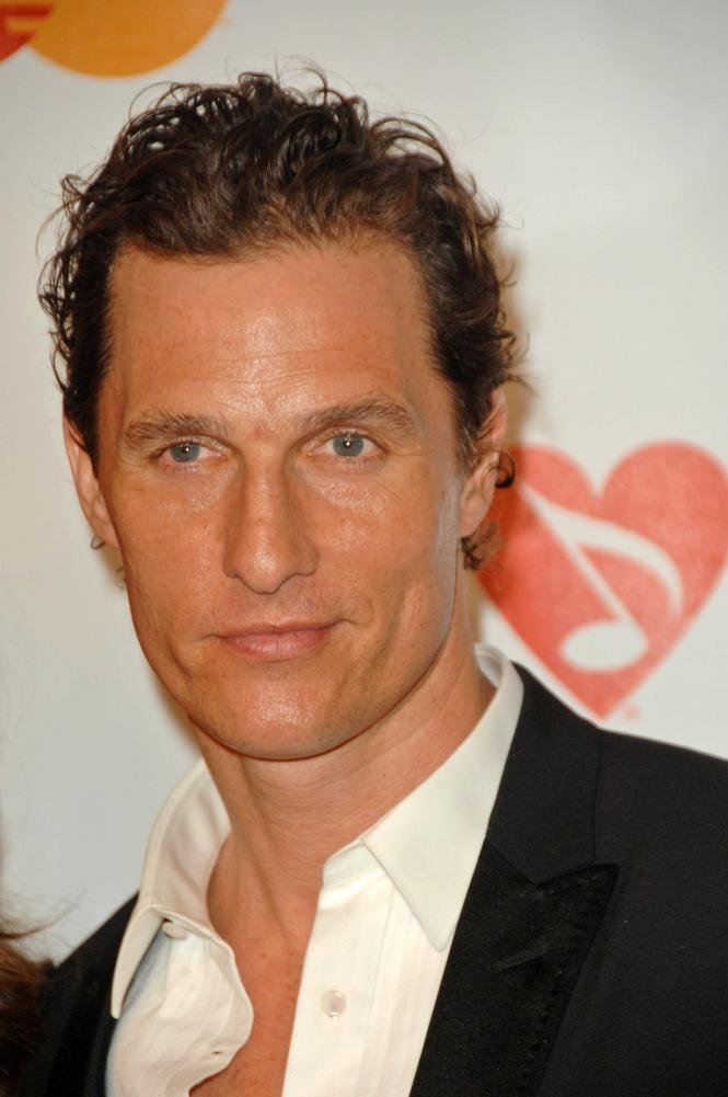 Matthew McConaughey’s Receding Hairline